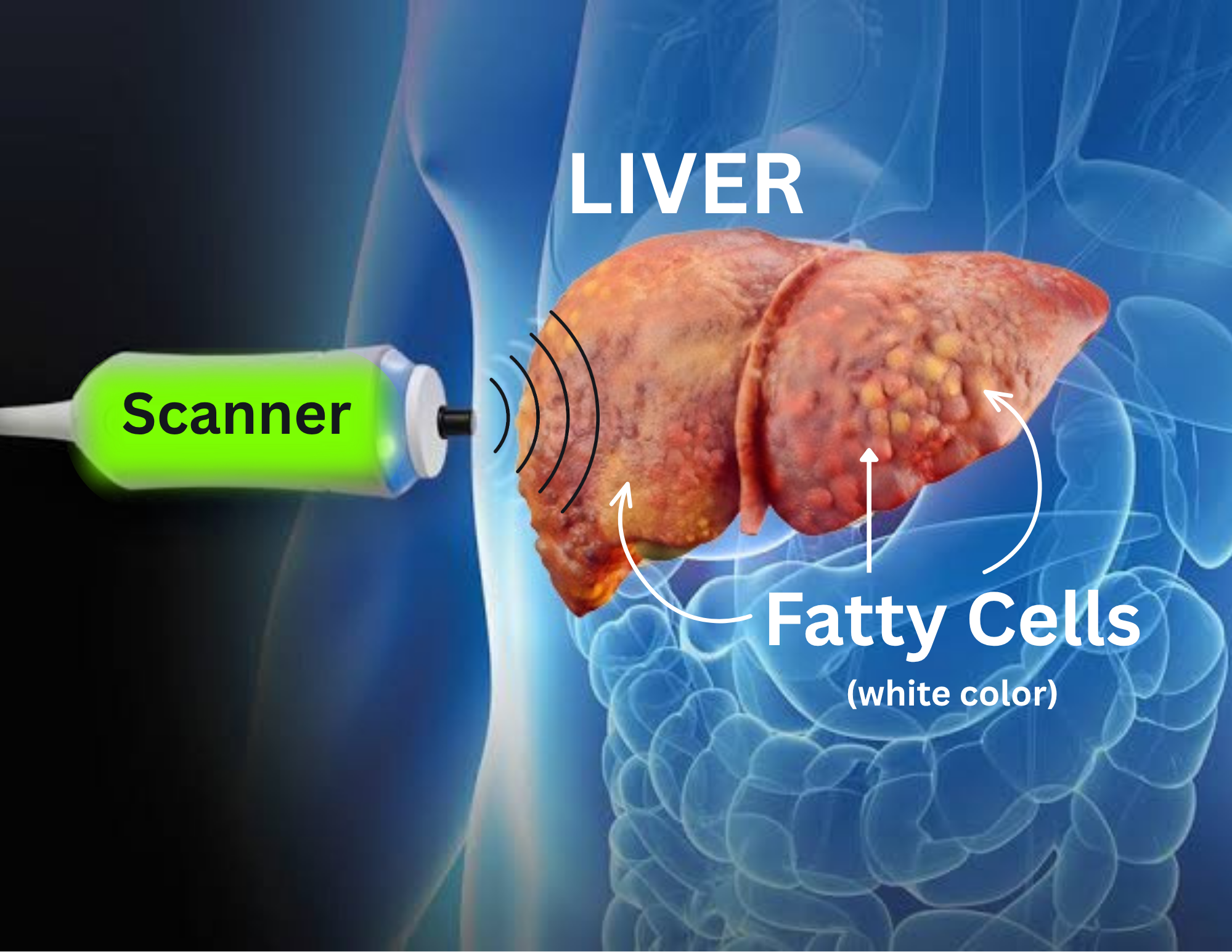 Liver Scan Machine